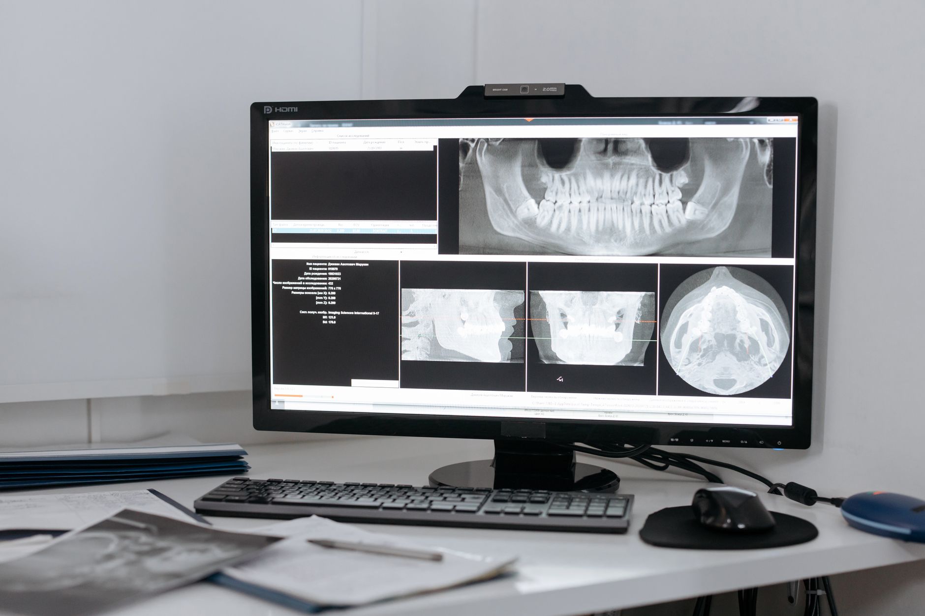 Dental x-ray images displayed on a clinic monitor