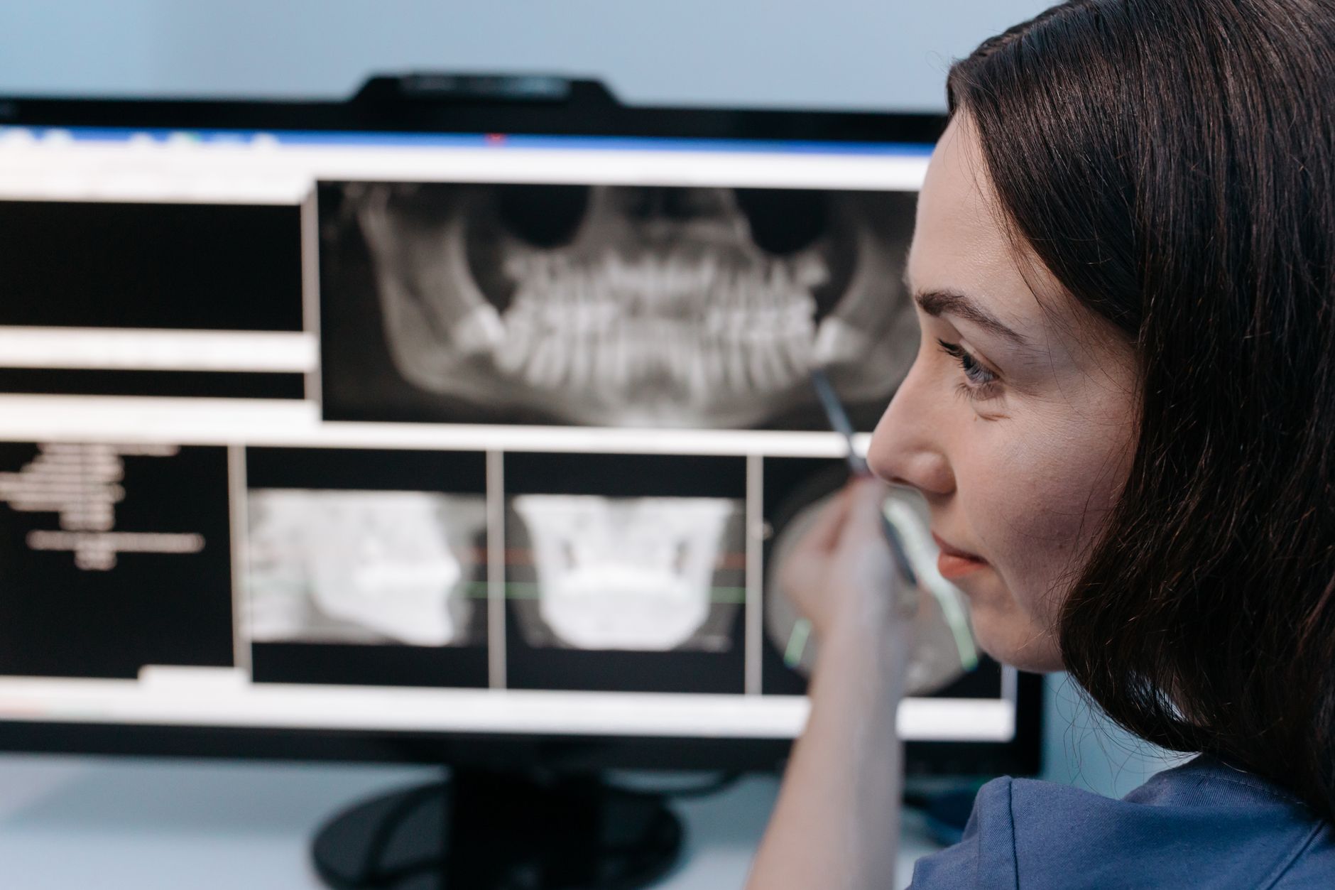 Dental x-ray of a jaw displayed on a computer screen